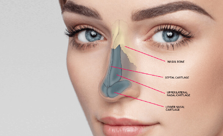 Closed Rhinoplasty