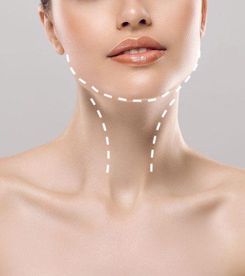 Double Chin Liposuction