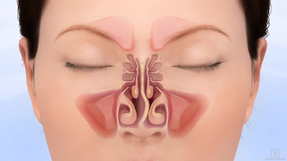 Deviation Correction